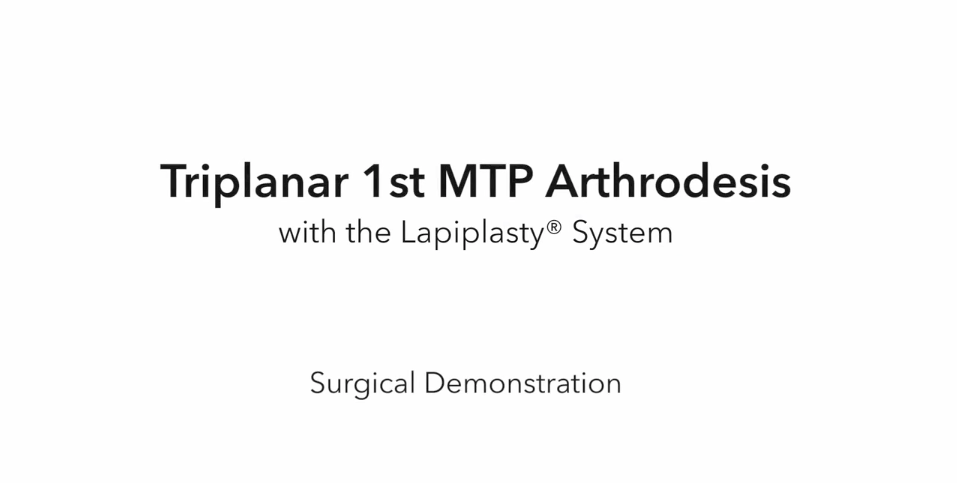 Triplanar 1st MTP Arthrodesis: Surgical Demonstration