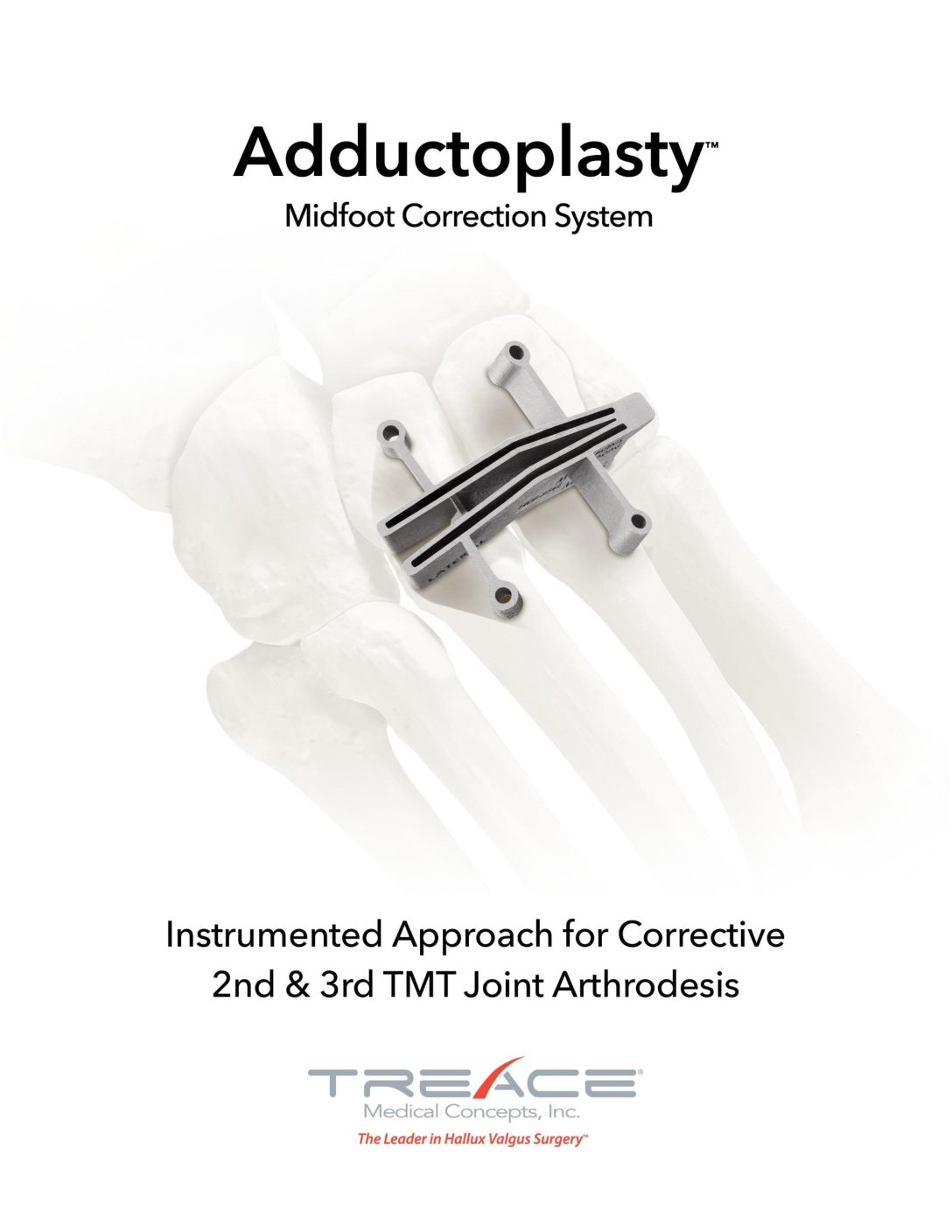 Adductoplasty® Key Steps & Fluoro Checks