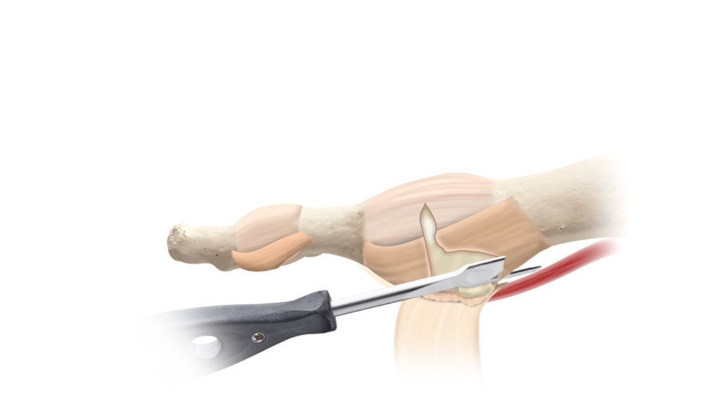 Surgical Demonstration