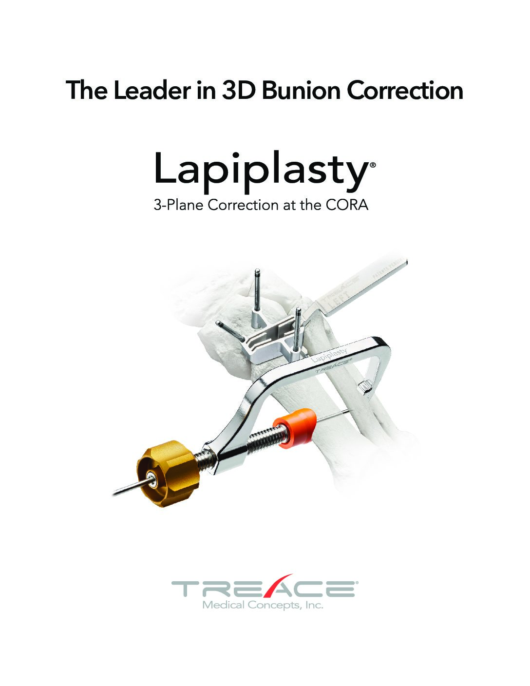 Lapiplasty® Brochure