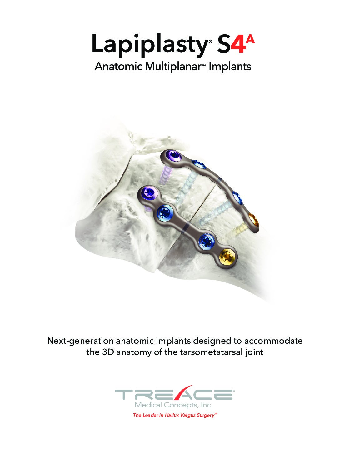 Lapiplasty® S4a Sales Sheet