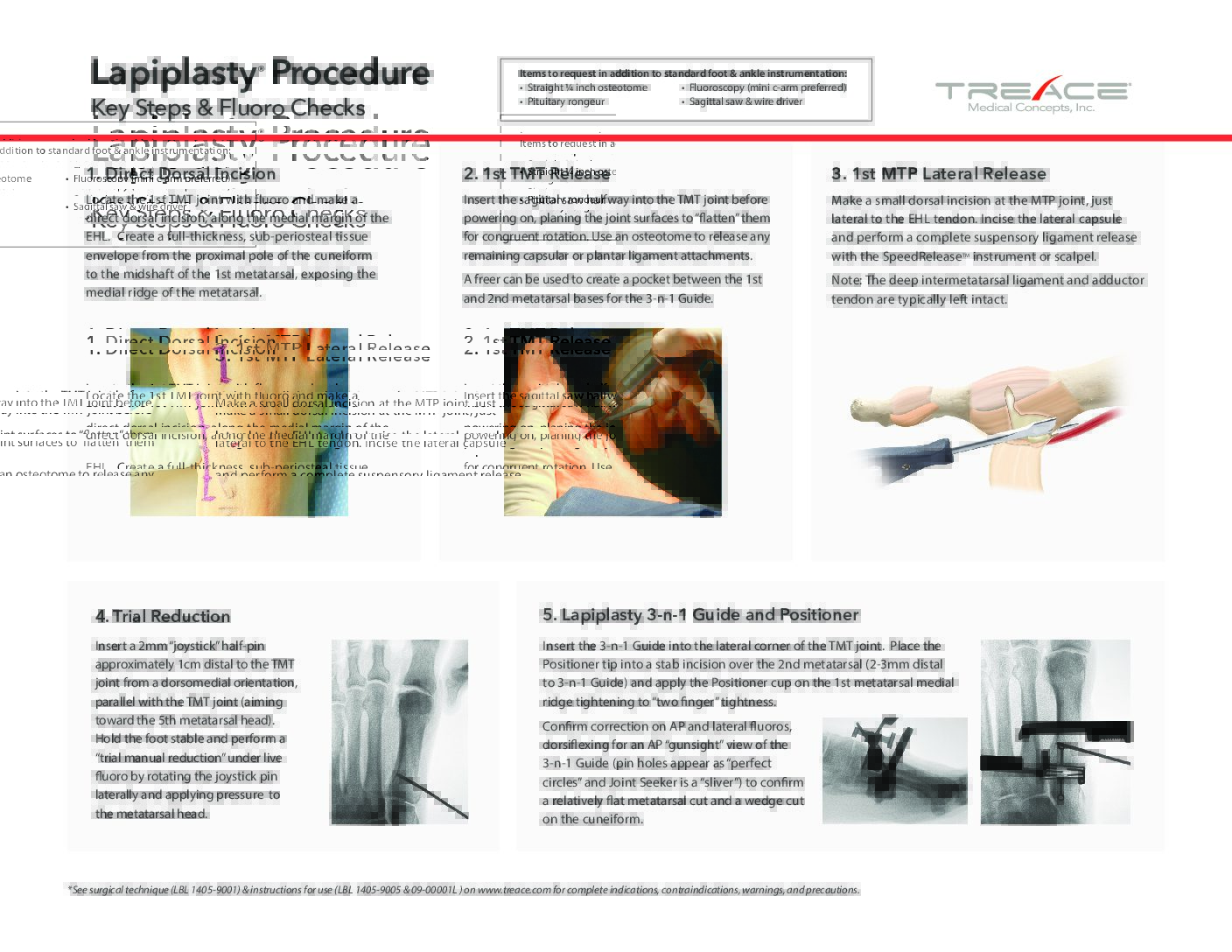 09-00016L Lapiplasty® 10 Step Guide