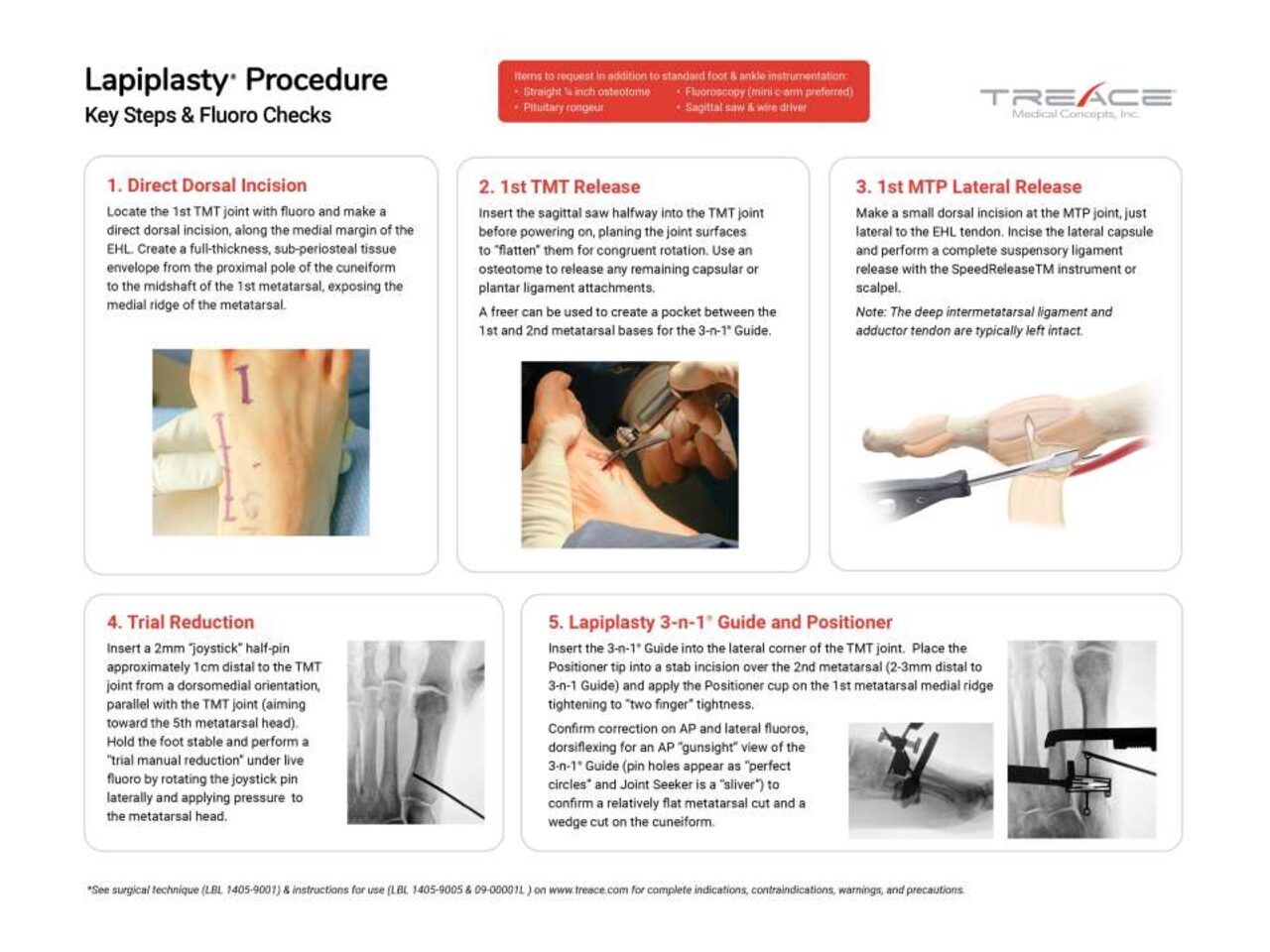 Lapiplasty® 10 Step Guide