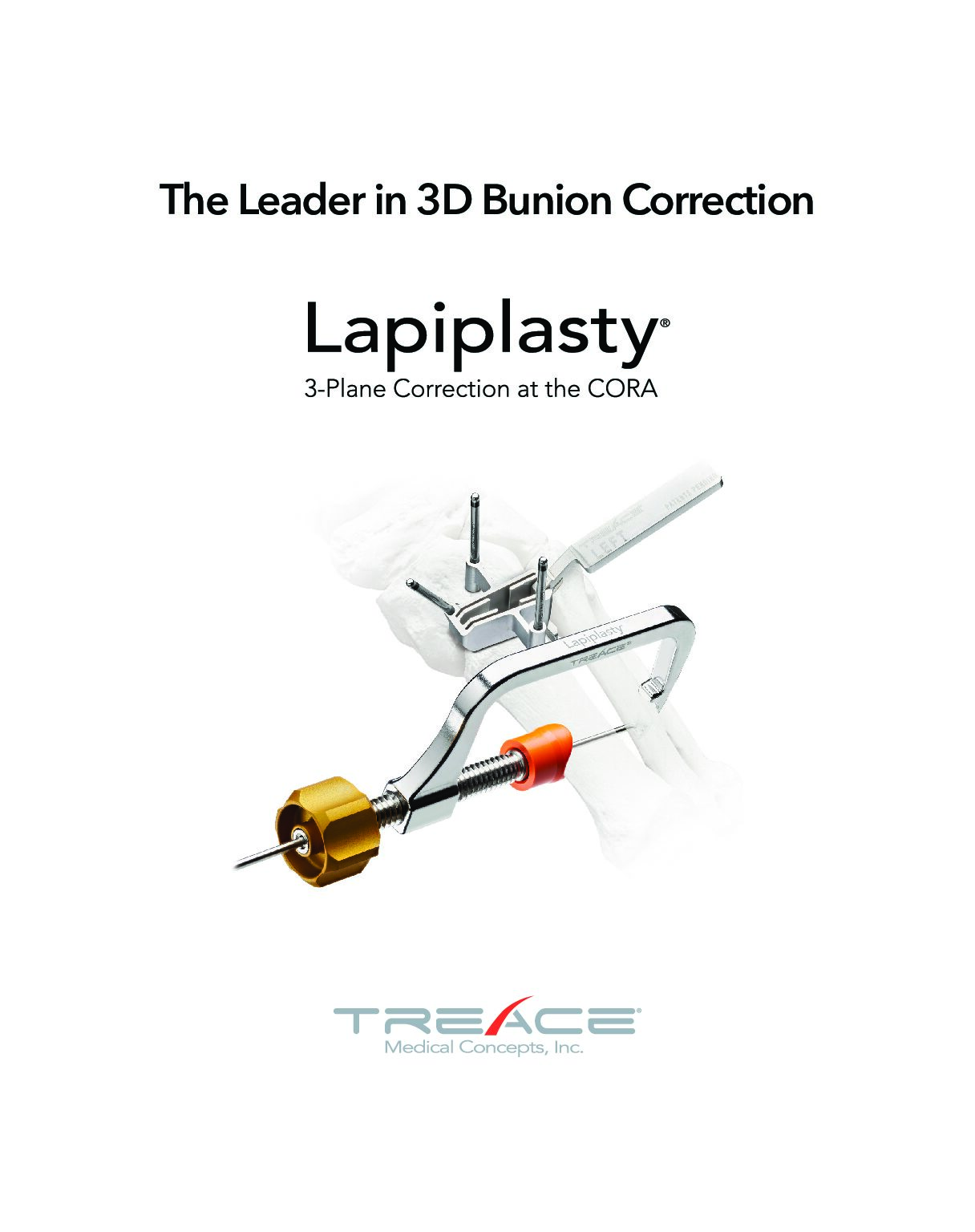 Lapiplasty® Brochure