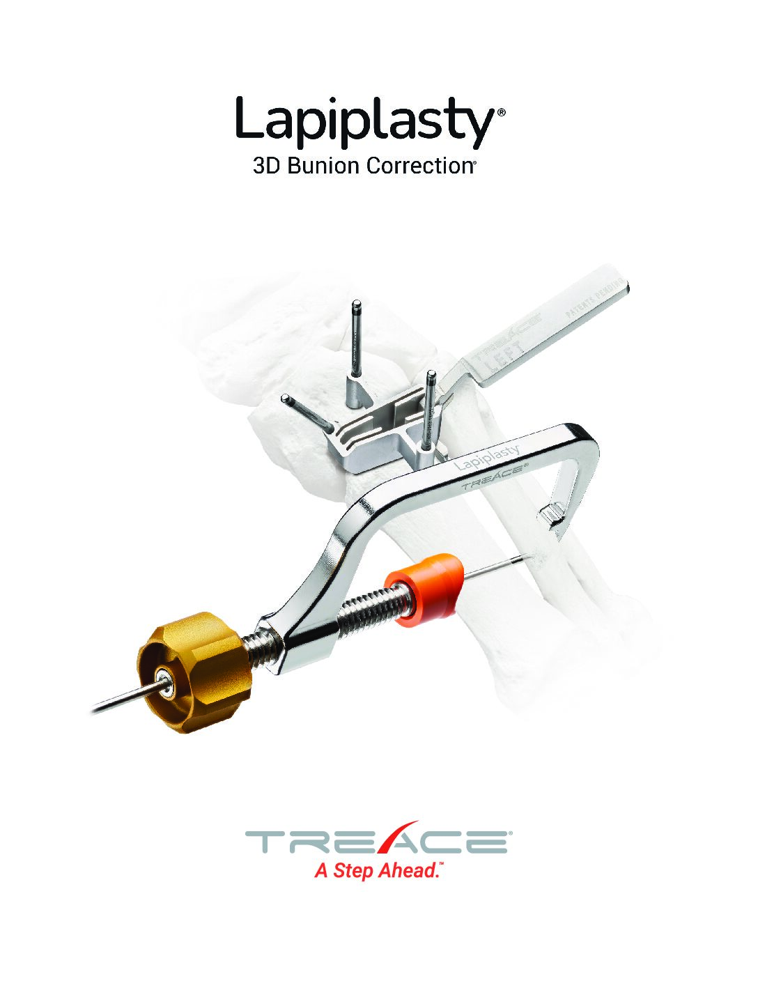 Lapiplasty® Brochure