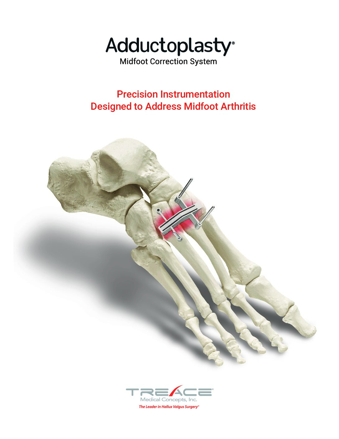 Adductoplasty® System Sales Sheet