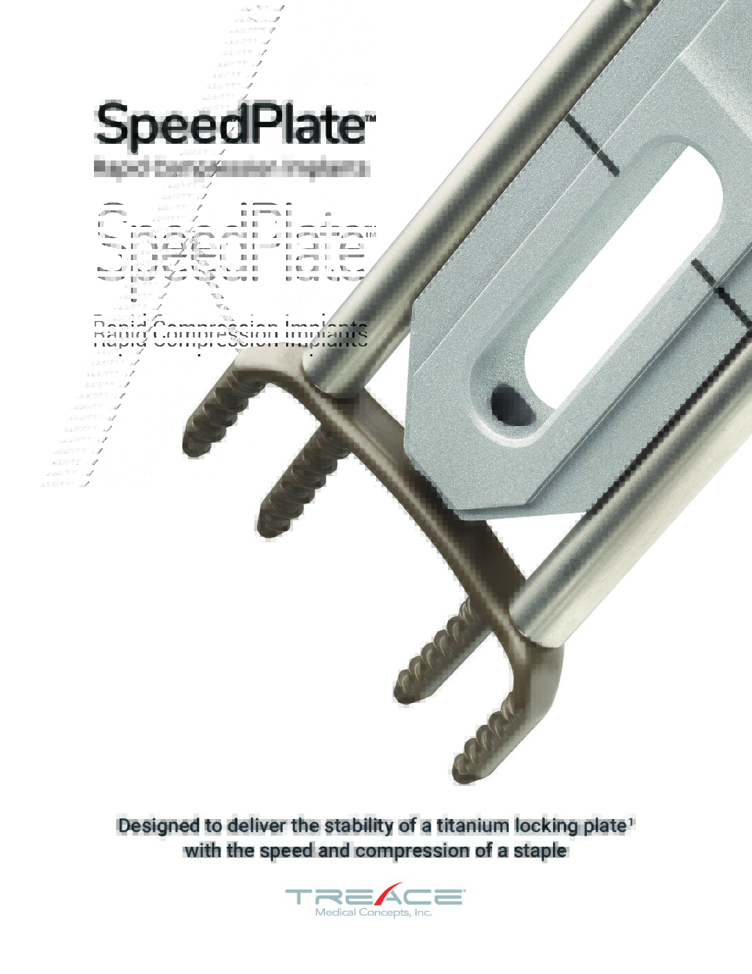 Lapiplasty® SpeedPlate™ Sales Sheet