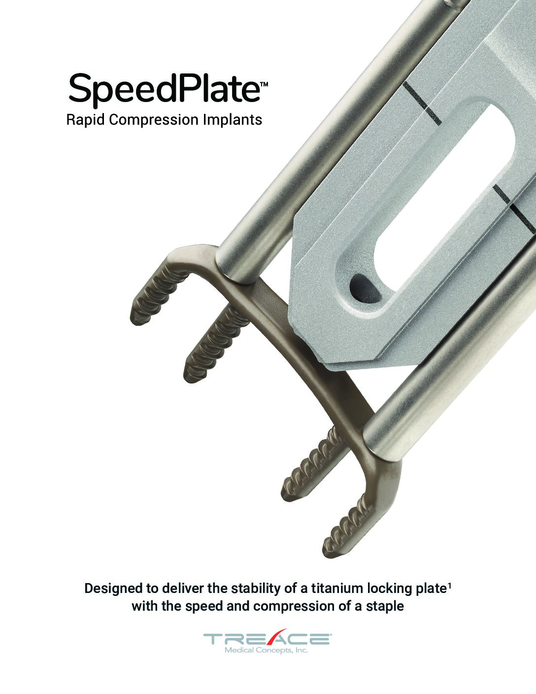 Lapiplasty® SpeedPlate™ Brochure