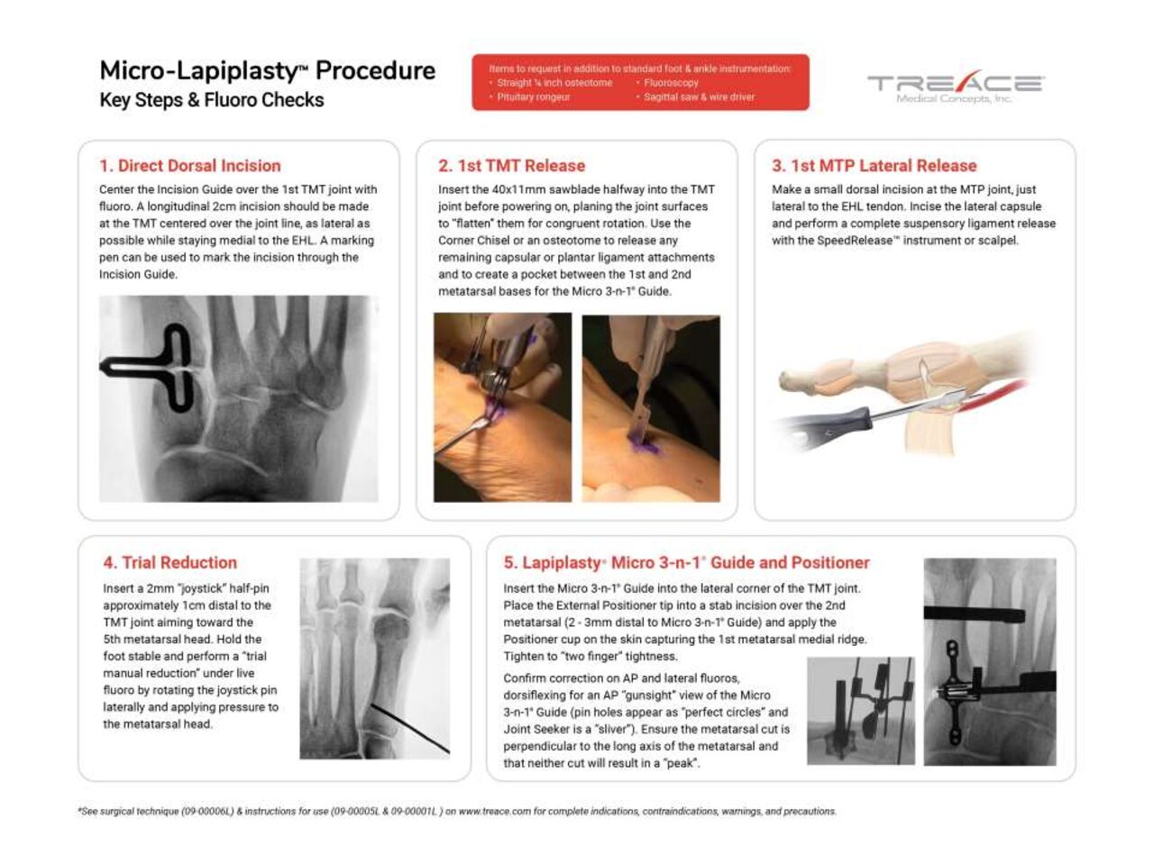 Key Steps & Fluoro Checks