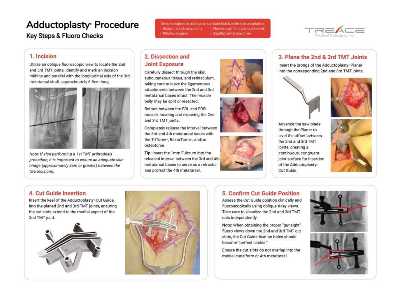 Key Steps & Fluoro Checks