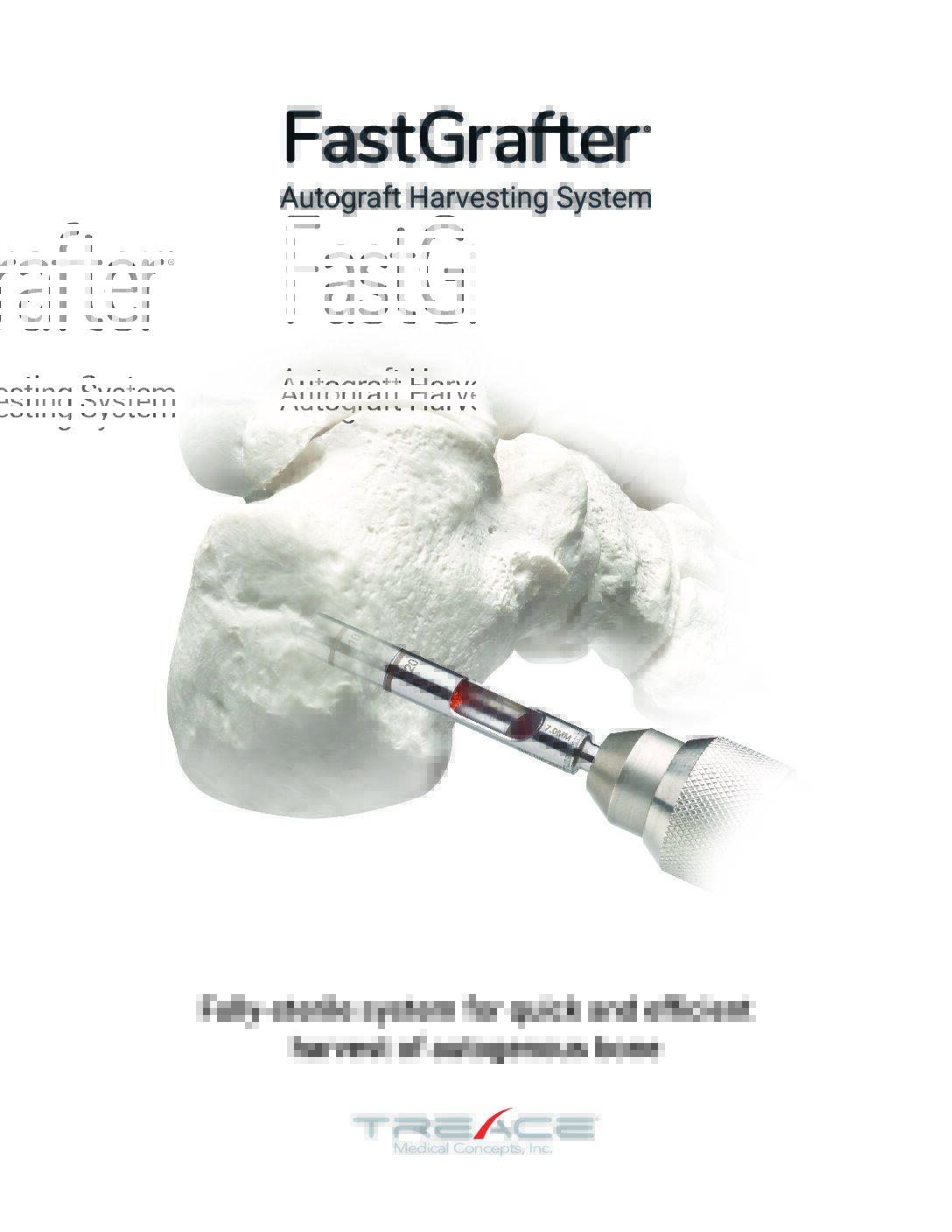 FastGrafter® Brochure