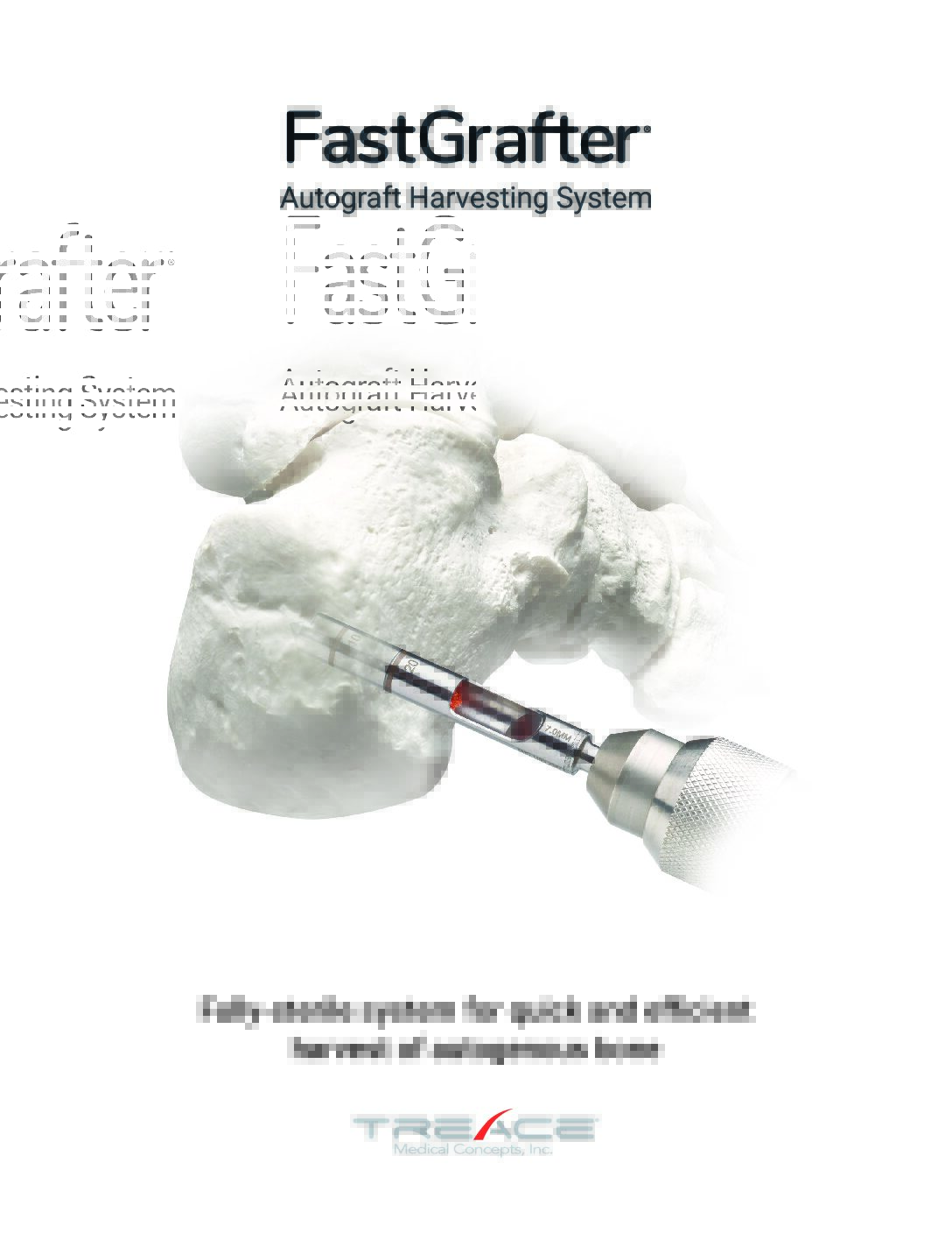 FastGrafter® Brochure