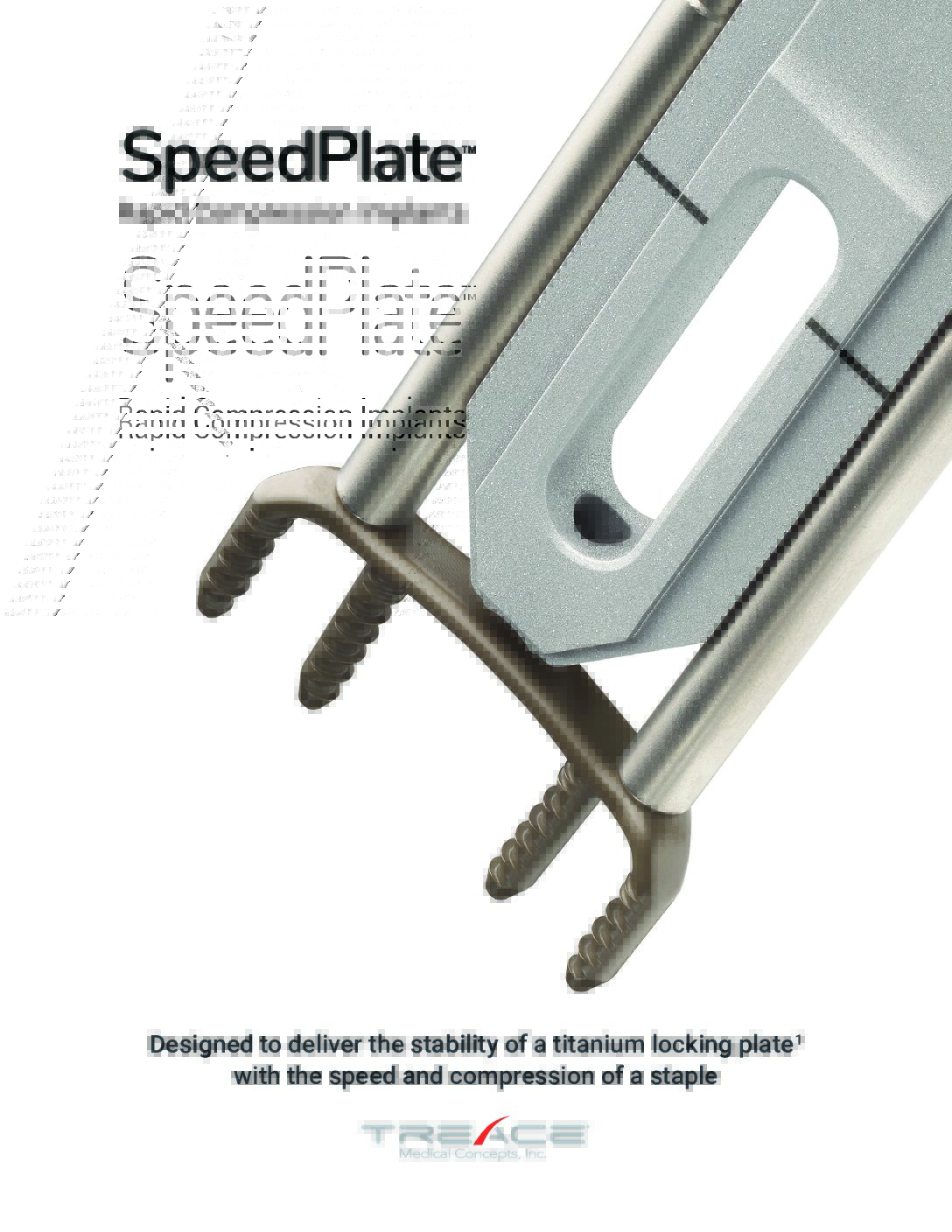 SpeedPlate™ Overview Brochure