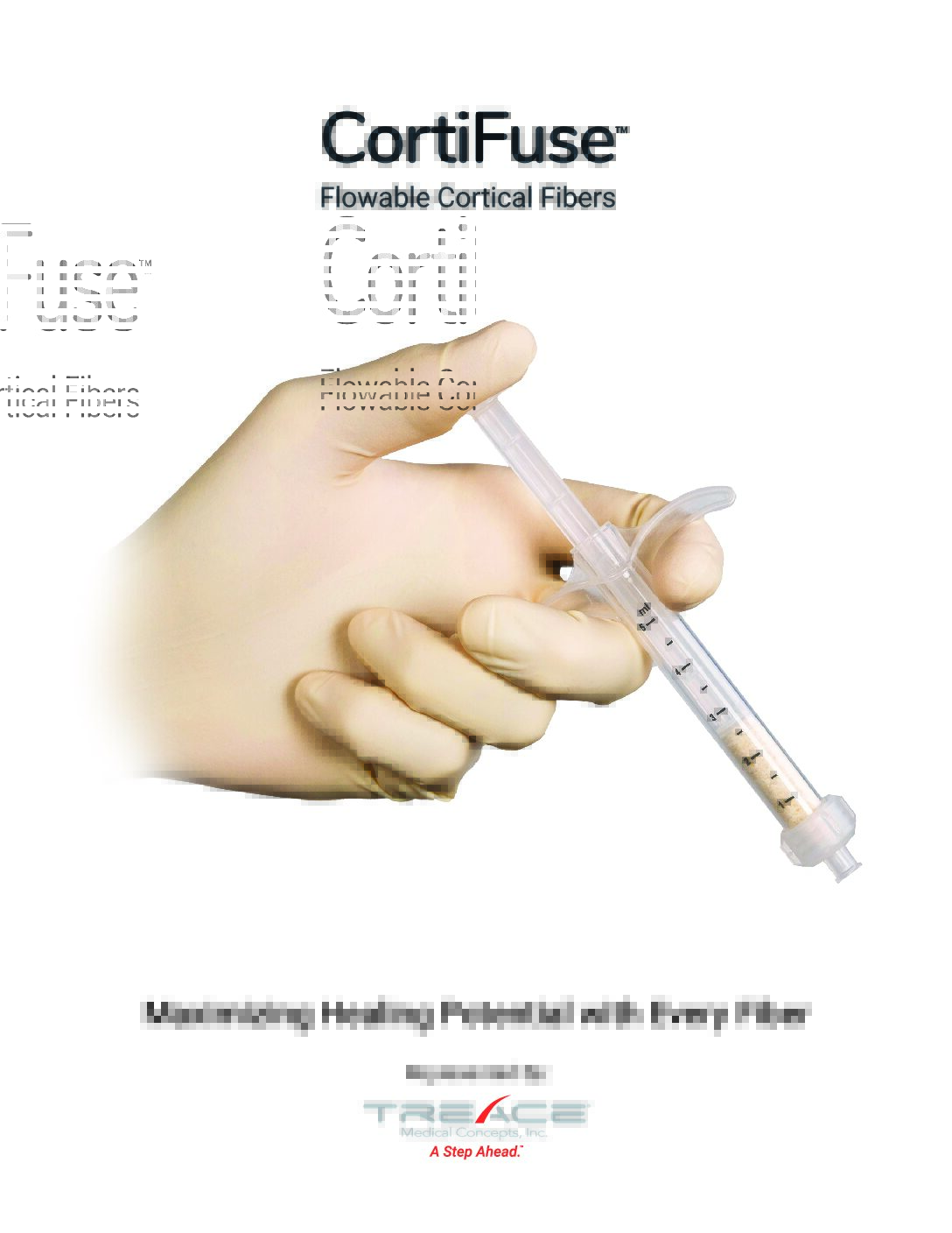 CortiFuse™ Sales Sheet