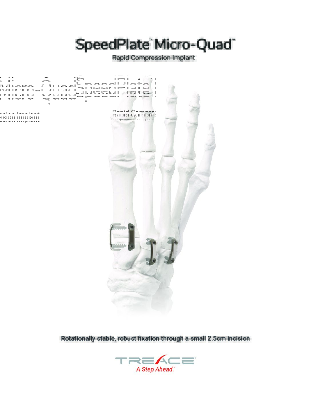 SpeedPlate™ Micro-Quad™ Overview Brochure