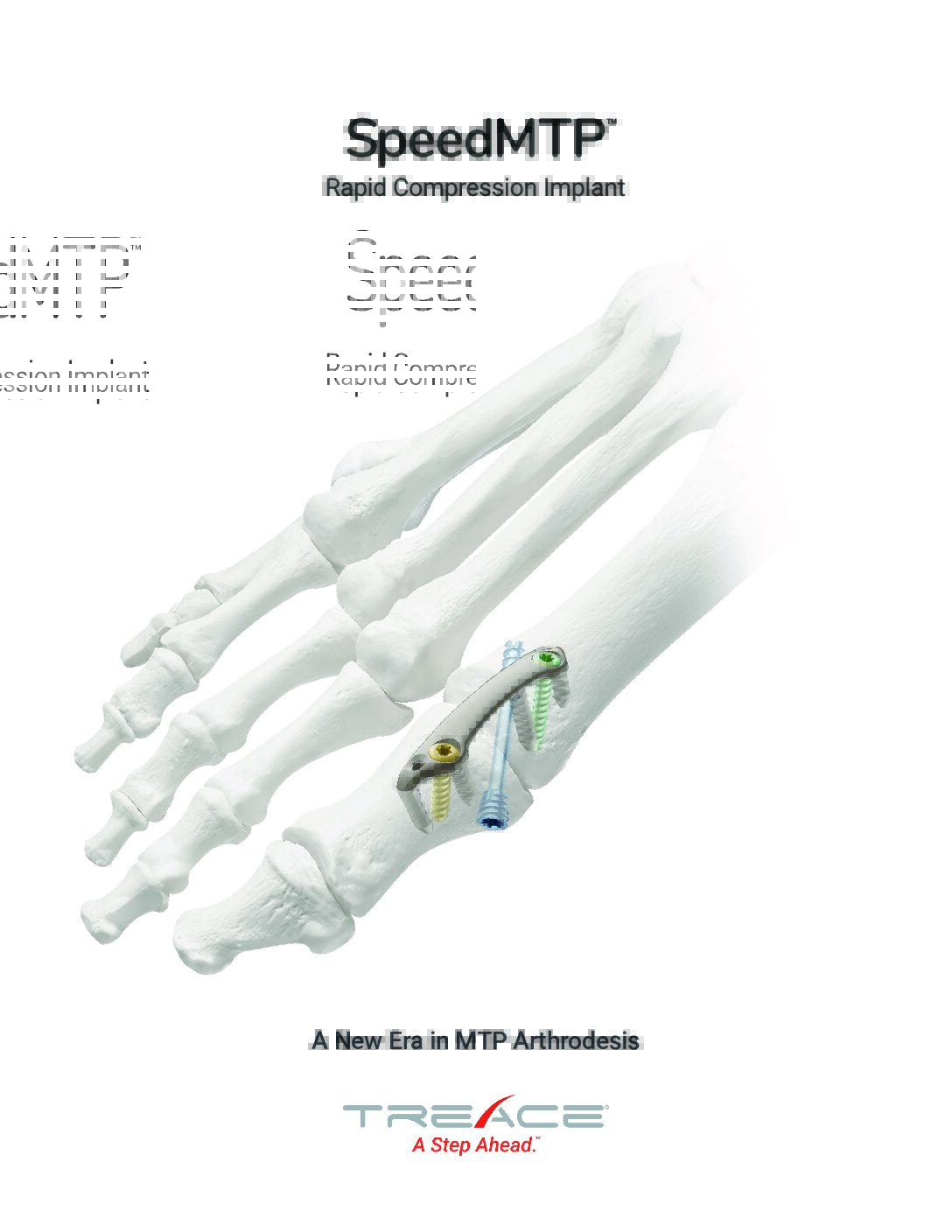 SpeedMTP™ Overview