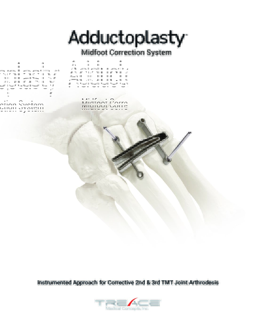 Adductoplasty® Brochure