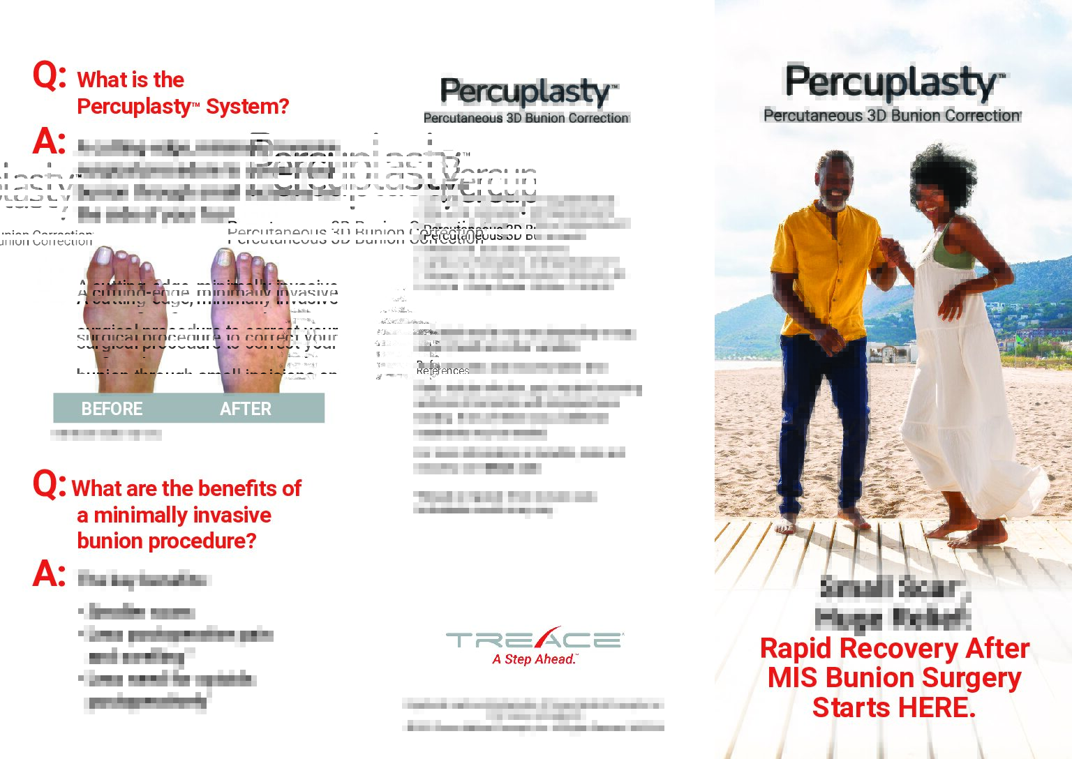 Percuplasty™ Patient Brochure